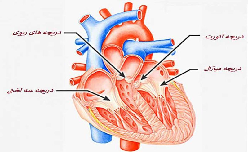 گشادی دریچه آئورت چیست؟