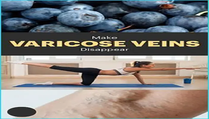  درمان‌های خانگی و تغییر سبک زندگی