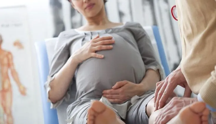 واریس در بارداری