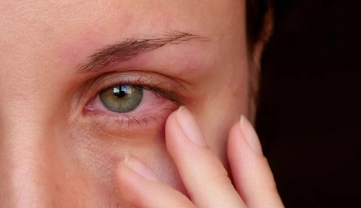 اثرات چربی خون بر چشم